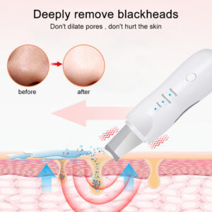 Ultrasonic Skin Scrubber Deep Face Cleaning Machine Peeling Shovel Facial Pore Cleaner Face Skin Scrubber Lift Beauty Instrument Ultrasonic Facial Scrubber Pore Blackhead Remover Spatula Deep Skin Spa - Image 4