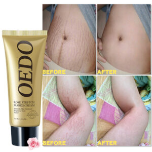Makeup OEDO Rose Renchen Cream - Image 3