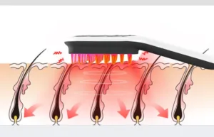 Electric Head Massager Magnetic Therapy Hair Growth Comb - Image 3
