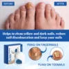 Nail Care Phototherapy Device Gentle Cleaning - Image 3