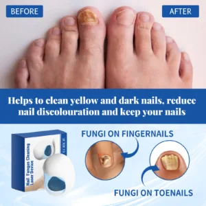 Nail Care Phototherapy Device Gentle Cleaning - Image 3