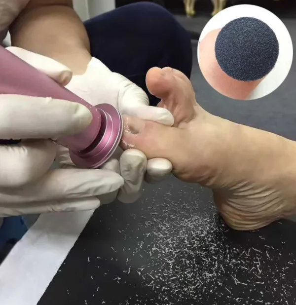 Electric Pedicure Foot Care Tool Files Pedicure Callus Remover Rechargeable Sawing File For Feet Dead Skin Callus Peel Remover - Image 2